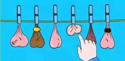 SeminalVesiculitiscauseSmallerTesticle