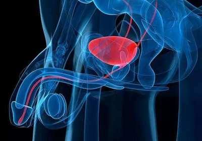 ProstateCongestionandProstatitis