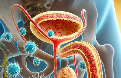 CanCandidaCauseProstatitis