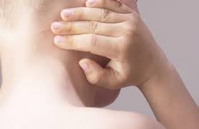 mumps with orchitis