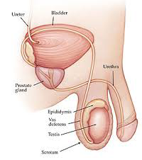 epididymitis