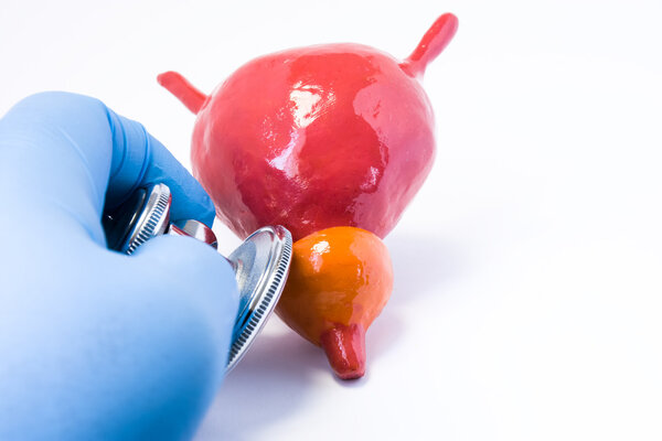 Herbal Medicine Diuretic